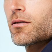 Biostimolazione con filler mandibola per una jawline definita